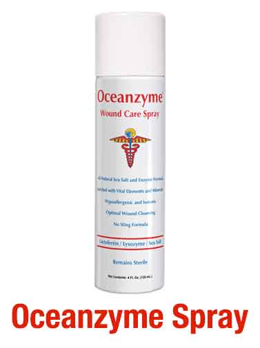 Oceanzyme Spray - Ocean Aid